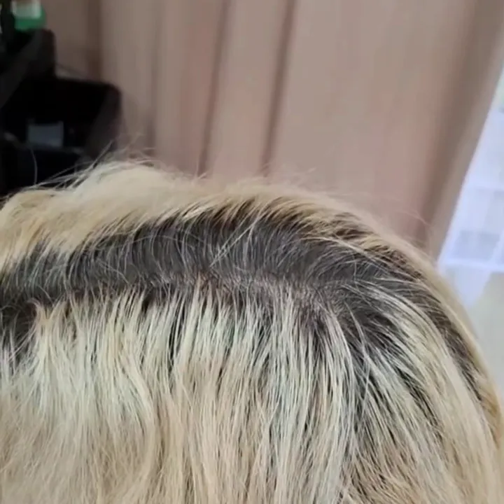 Before: yellow blonde bob with dark regrowth